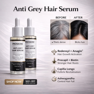 Proskire Anti-Grey Hair Serum – Prevents & Reverses Grey Hair, Reduces White Hair, Darkens & Revitalizes Hair Color – Controls Hair Fall