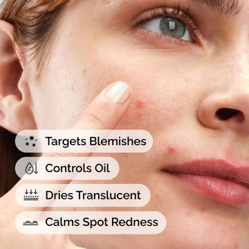 Clear Breakouts in 1 Hour | The Ordinary Powder-to-Cream + Ordinary Niacinamide Serum | Fastest Solution to reduce Acne, Spots & Redness Brightens Skin Tone