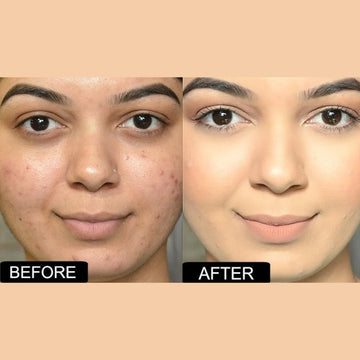 Chanel Ultra Glowy Foundation - Waterproof & Long-lasting